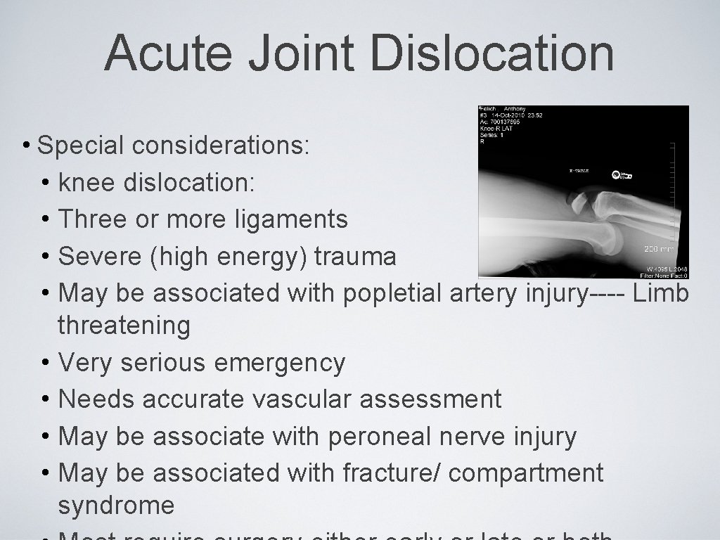 Acute Joint Dislocation • Special considerations: • knee dislocation: • Three or more ligaments