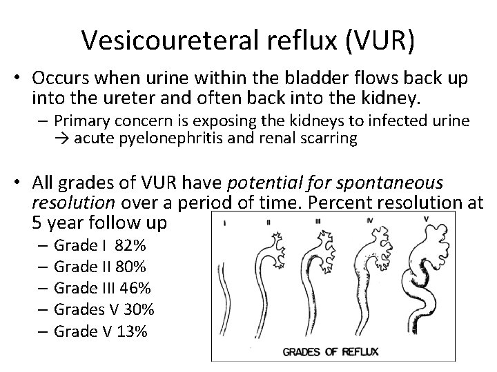 Vesicoureteral reflux (VUR) • Occurs when urine within the bladder flows back up into