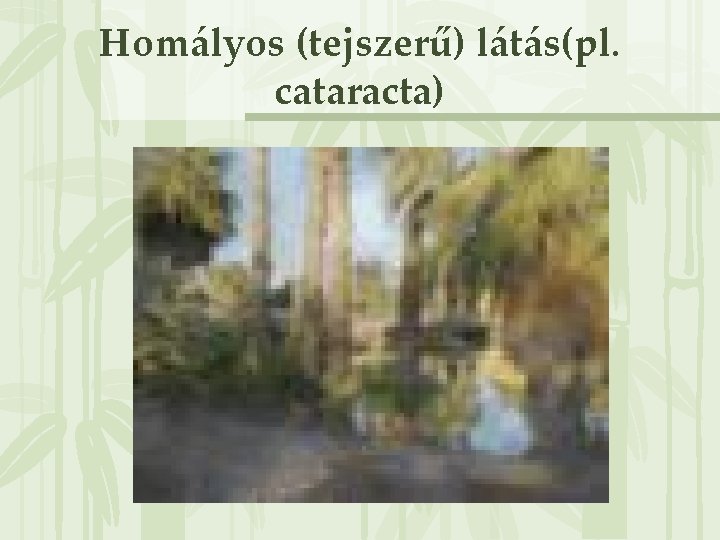 Homályos (tejszerű) látás(pl. cataracta) 