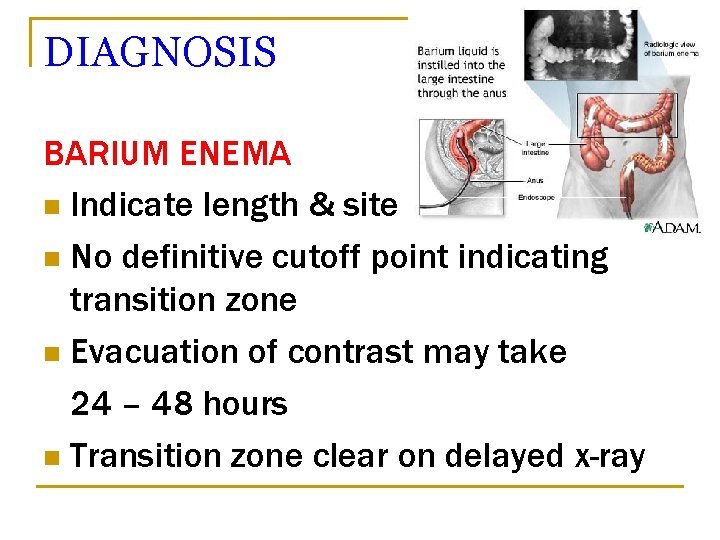 DIAGNOSIS BARIUM ENEMA n Indicate length & site n No definitive cutoff point indicating