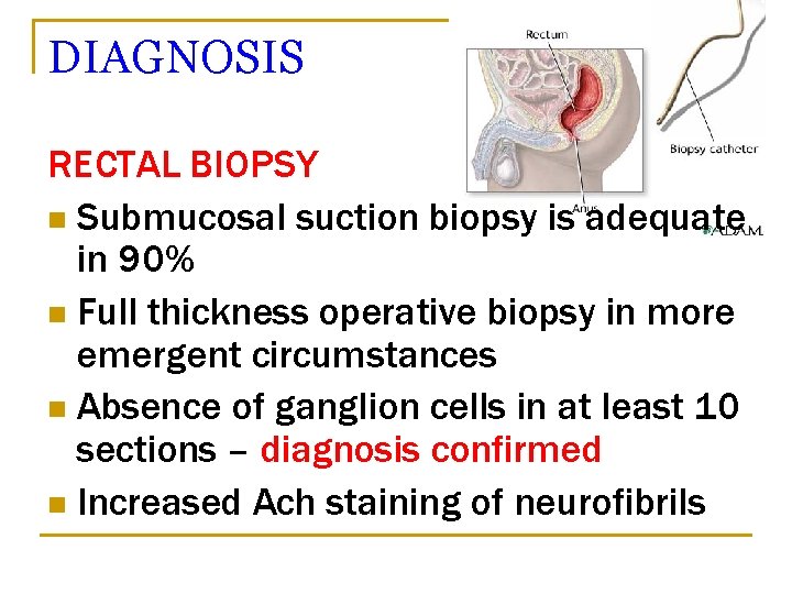 DIAGNOSIS RECTAL BIOPSY n Submucosal suction biopsy is adequate in 90% n Full thickness