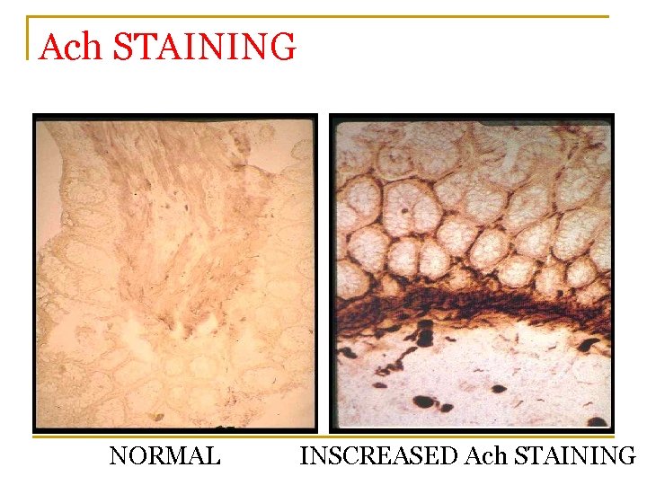 Ach STAINING NORMAL INSCREASED Ach STAINING 