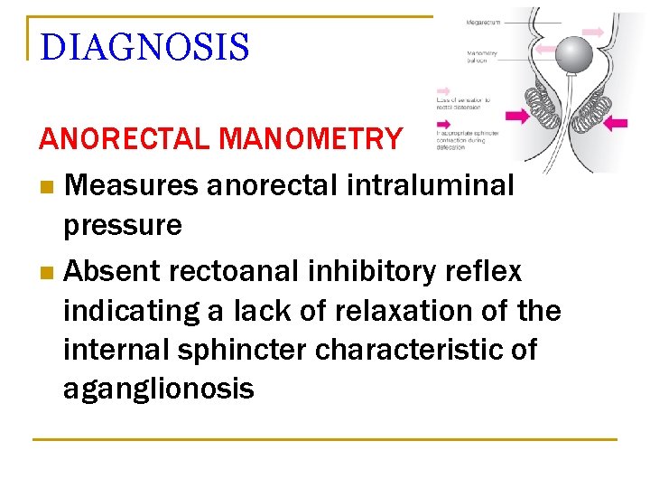 DIAGNOSIS ANORECTAL MANOMETRY n Measures anorectal intraluminal pressure n Absent rectoanal inhibitory reflex indicating