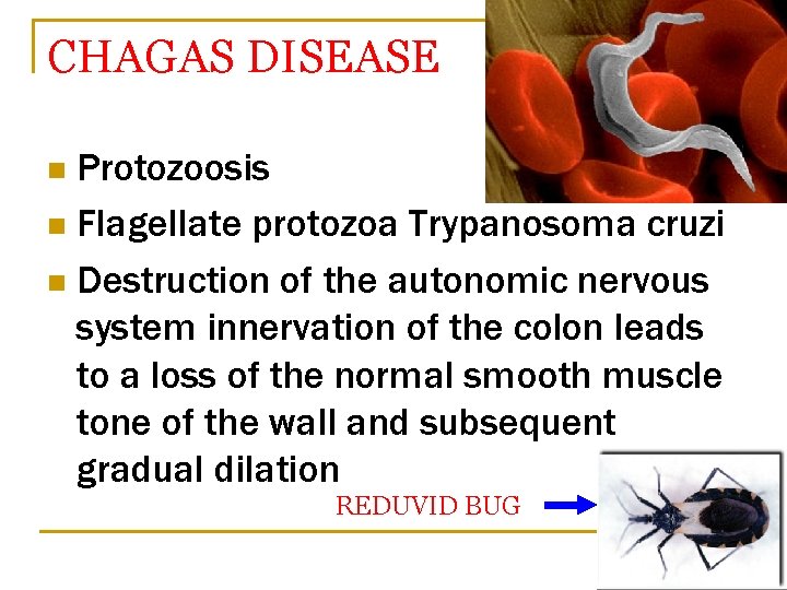 CHAGAS DISEASE Protozoosis n Flagellate protozoa Trypanosoma cruzi n Destruction of the autonomic nervous