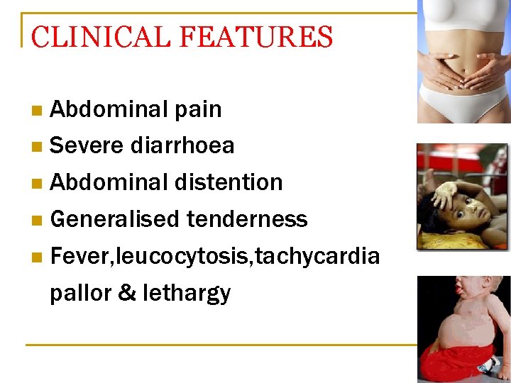 CLINICAL FEATURES Abdominal pain n Severe diarrhoea n Abdominal distention n Generalised tenderness n