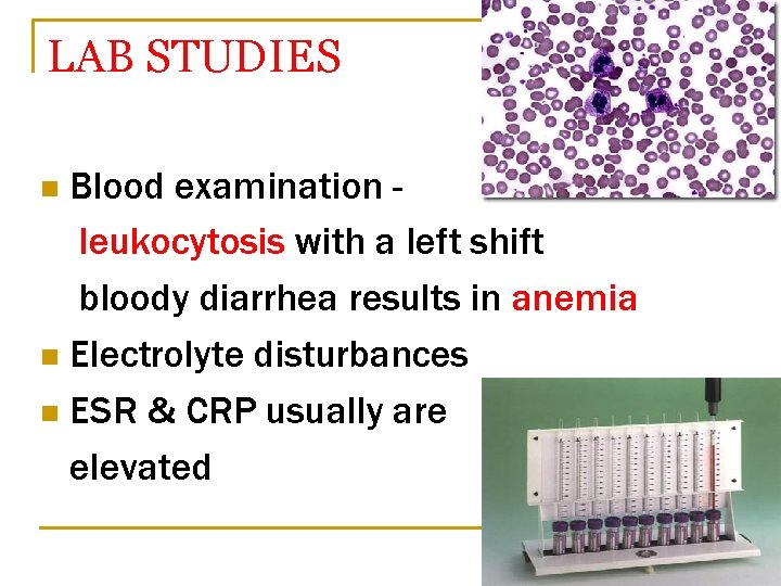 LAB STUDIES Blood examination leukocytosis with a left shift bloody diarrhea results in anemia