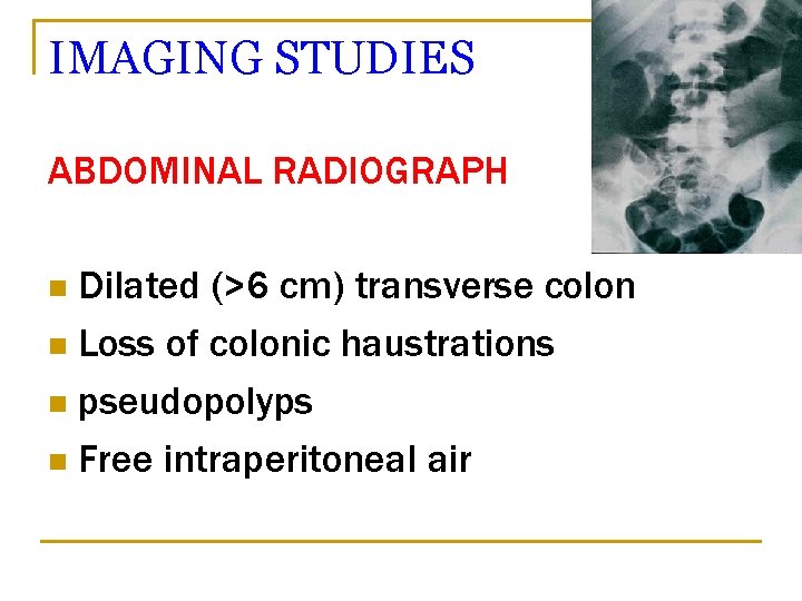 IMAGING STUDIES ABDOMINAL RADIOGRAPH Dilated (>6 cm) transverse colon n Loss of colonic haustrations