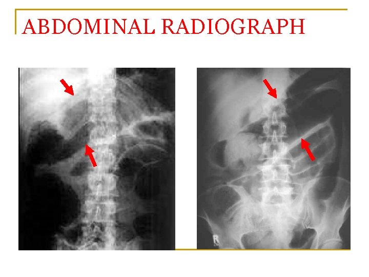 ABDOMINAL RADIOGRAPH 