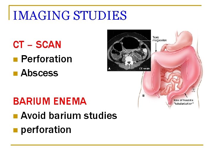 IMAGING STUDIES CT – SCAN n Perforation n Abscess BARIUM ENEMA n Avoid barium