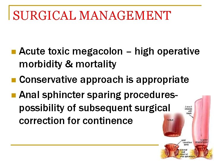 SURGICAL MANAGEMENT Acute toxic megacolon – high operative morbidity & mortality n Conservative approach