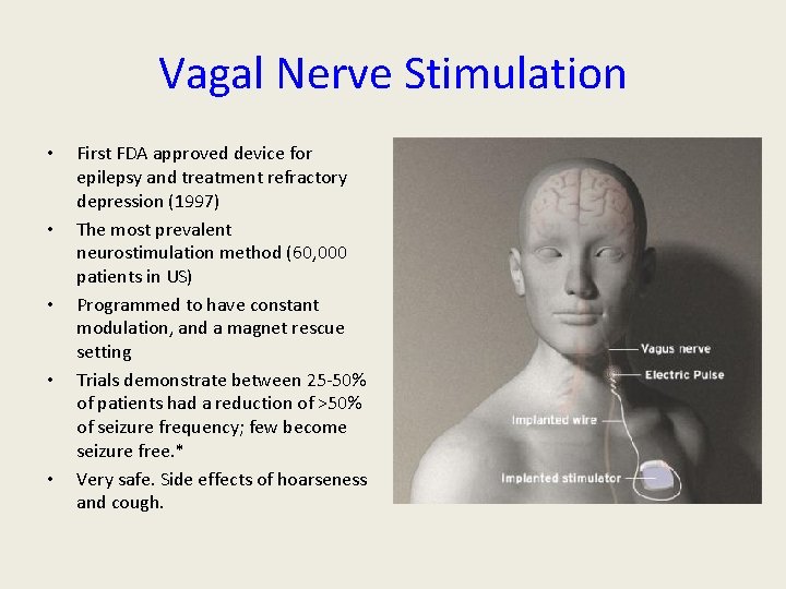 Vagal Nerve Stimulation • • • First FDA approved device for epilepsy and treatment Vagal Nerve Stimulation • • • First FDA approved device for epilepsy and treatment