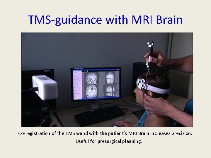 TMS-guidance with MRI Brain Co-registration of the TMS wand with the patient’s MRI Brain TMS-guidance with MRI Brain Co-registration of the TMS wand with the patient’s MRI Brain