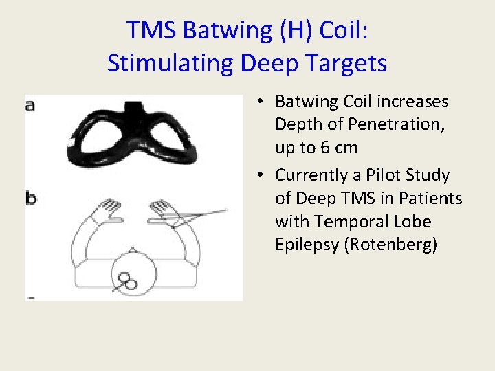 TMS Batwing (H) Coil: Stimulating Deep Targets • Batwing Coil increases Depth of Penetration, TMS Batwing (H) Coil: Stimulating Deep Targets • Batwing Coil increases Depth of Penetration,