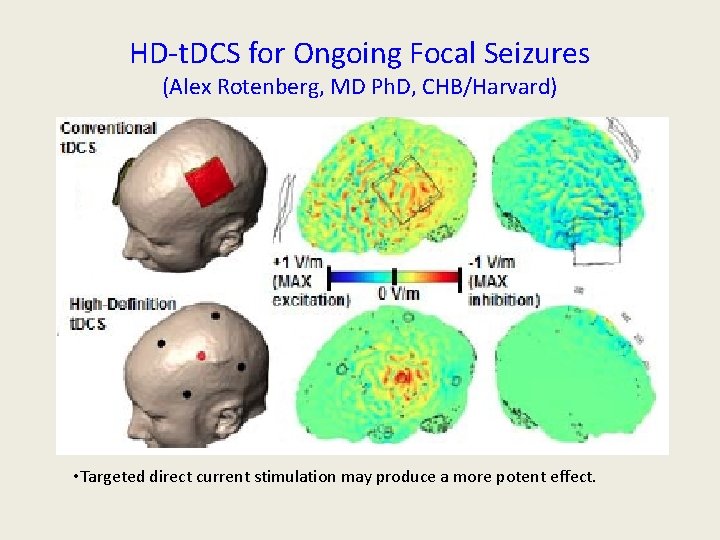 HD-t. DCS for Ongoing Focal Seizures (Alex Rotenberg, MD Ph. D, CHB/Harvard) • Targeted HD-t. DCS for Ongoing Focal Seizures (Alex Rotenberg, MD Ph. D, CHB/Harvard) • Targeted