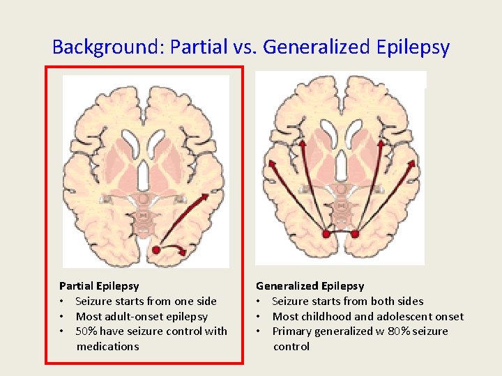 Background: Partial vs. Generalized Epilepsy Partial Epilepsy • Seizure starts from one side • Background: Partial vs. Generalized Epilepsy Partial Epilepsy • Seizure starts from one side •