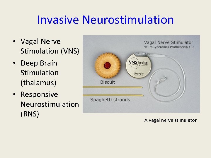 Invasive Neurostimulation • Vagal Nerve Stimulation (VNS) • Deep Brain Stimulation (thalamus) • Responsive Invasive Neurostimulation • Vagal Nerve Stimulation (VNS) • Deep Brain Stimulation (thalamus) • Responsive