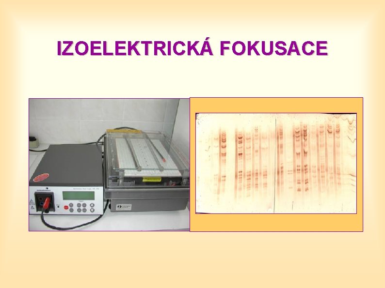 IZOELEKTRICKÁ FOKUSACE 