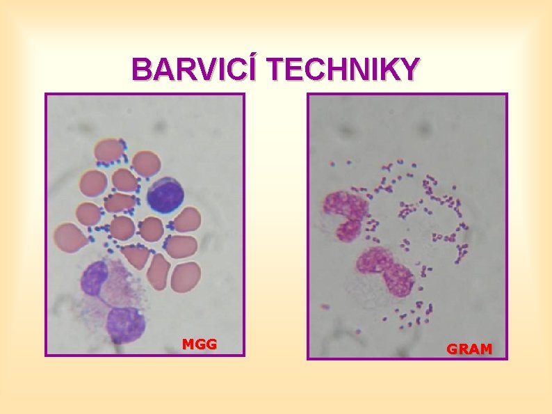BARVICÍ TECHNIKY MGG GRAM 