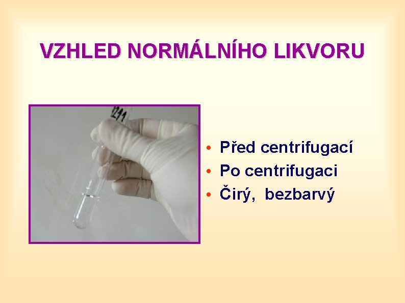 VZHLED NORMÁLNÍHO LIKVORU • Před centrifugací • Po centrifugaci • Čirý, bezbarvý 