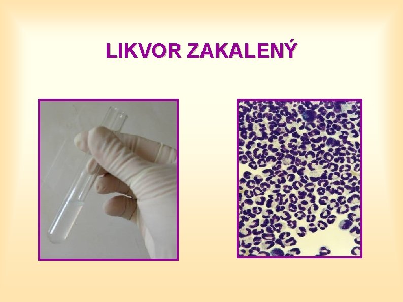 LIKVOR ZAKALENÝ 
