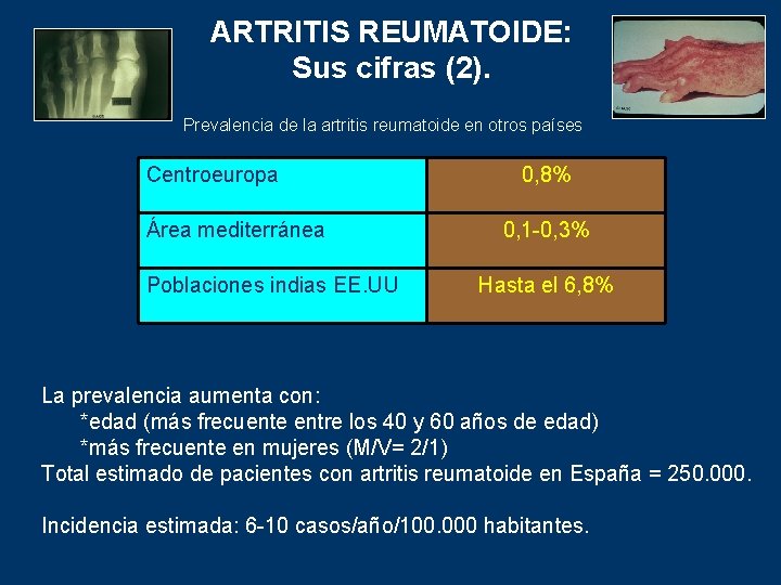 ARTRITIS REUMATOIDE: Sus cifras (2). Prevalencia de la artritis reumatoide en otros países Centroeuropa