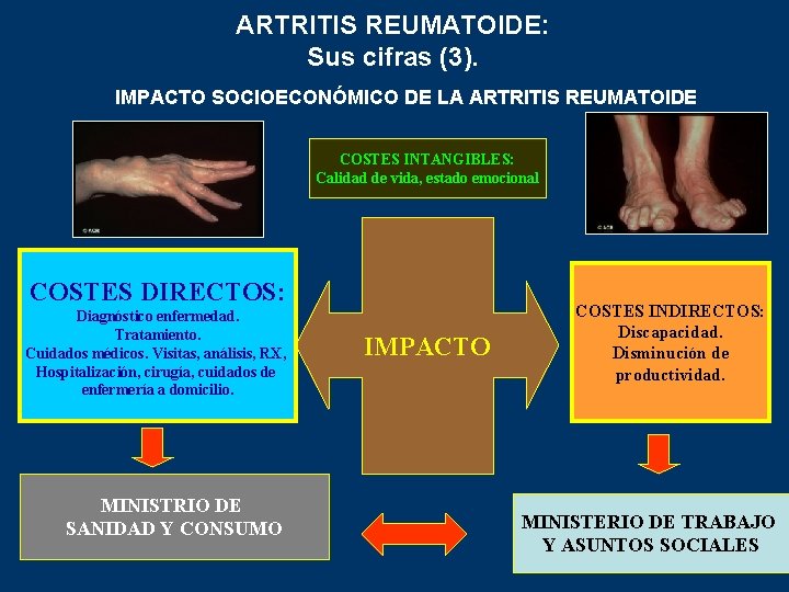 ARTRITIS REUMATOIDE: Sus cifras (3). IMPACTO SOCIOECONÓMICO DE LA ARTRITIS REUMATOIDE COSTES INTANGIBLES: Calidad