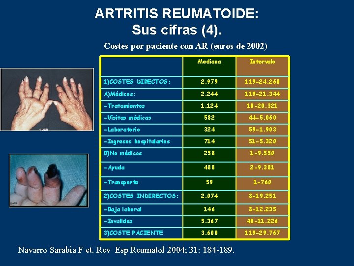 ARTRITIS REUMATOIDE: Sus cifras (4). Costes por paciente con AR (euros de 2002) Mediana