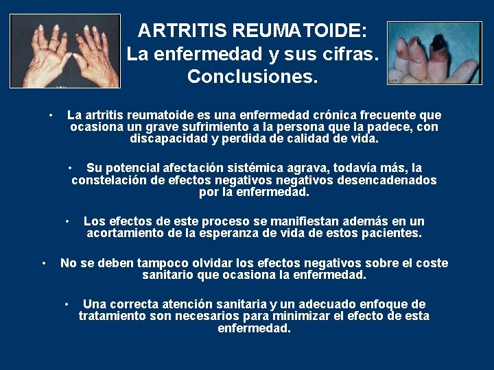 ARTRITIS REUMATOIDE: La enfermedad y sus cifras. Conclusiones. • La artritis reumatoide es una