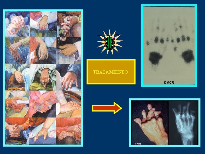 TRATAMIENTO 