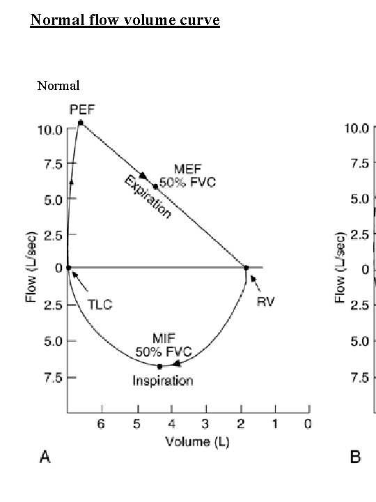 Normal flow volume curve Normal 