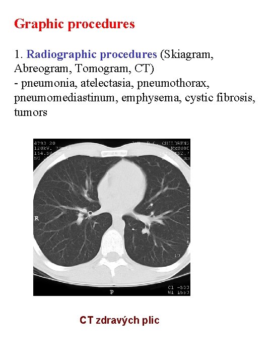 Graphic procedures 1. Radiographic procedures (Skiagram, Abreogram, Tomogram, CT) - pneumonia, atelectasia, pneumothorax, pneumomediastinum,