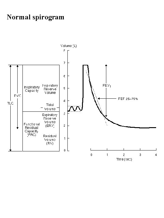 Normal spirogram 
