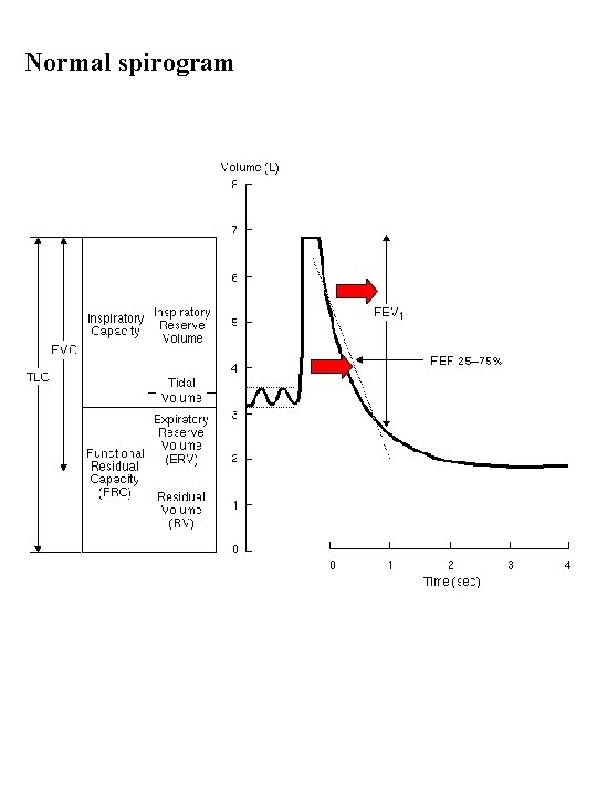 Normal spirogram 