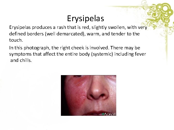 Erysipelas produces a rash that is red, slightly swollen, with very defined borders (well