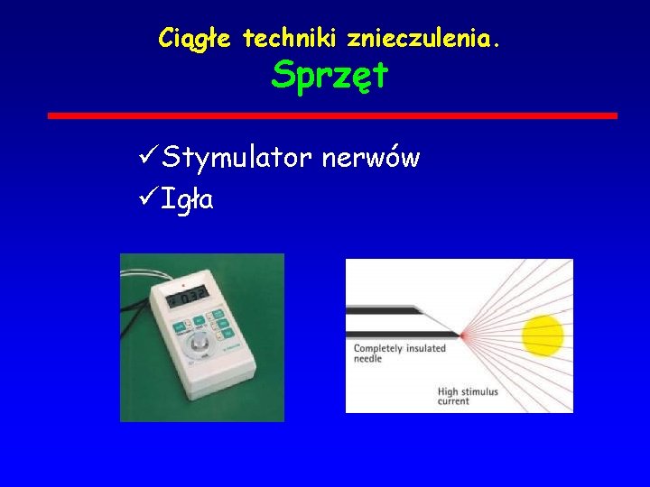 Ciągłe techniki znieczulenia. Sprzęt ü Stymulator nerwów ü Igła 