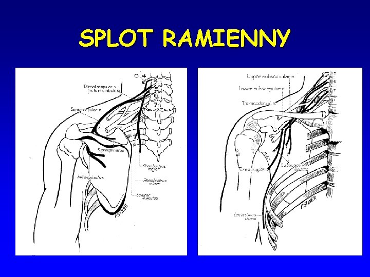 SPLOT RAMIENNY 