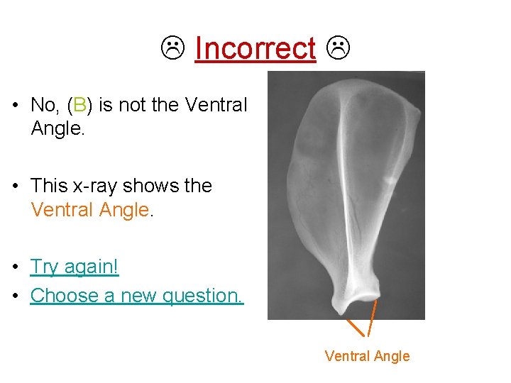  Incorrect • No, (B) is not the Ventral Angle. • This x-ray shows