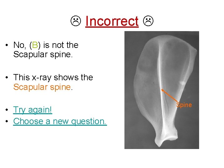  Incorrect • No, (B) is not the Scapular spine. • This x-ray shows