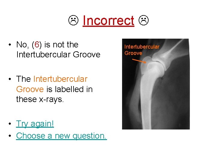  Incorrect • No, (6) is not the Intertubercular Groove • The Intertubercular Groove