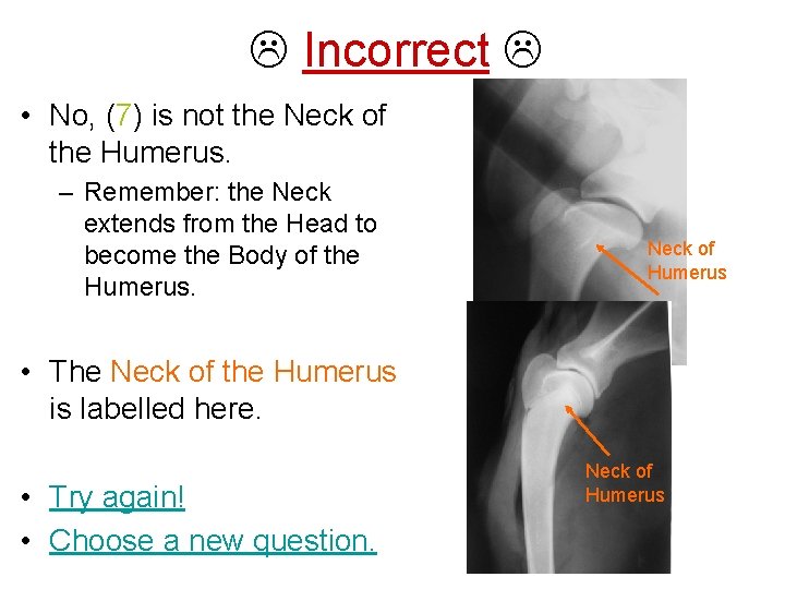  Incorrect • No, (7) is not the Neck of the Humerus. – Remember: