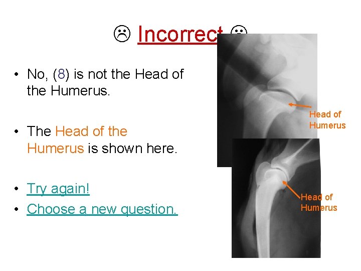  Incorrect • No, (8) is not the Head of the Humerus. • The