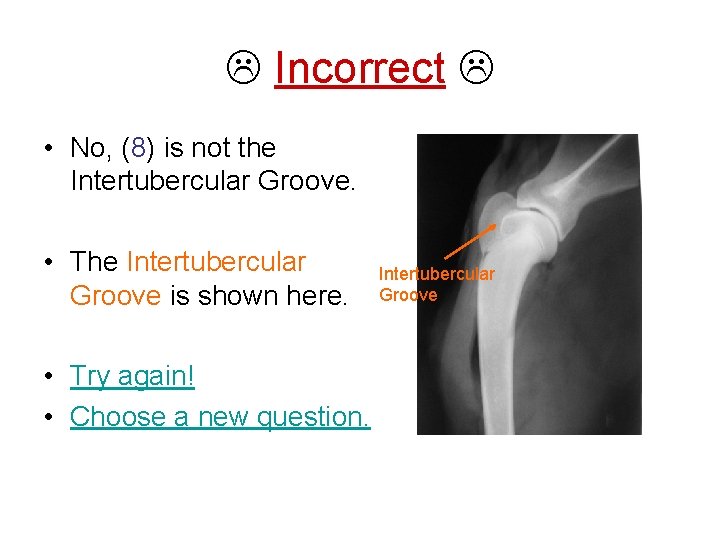  Incorrect • No, (8) is not the Intertubercular Groove. • The Intertubercular Groove