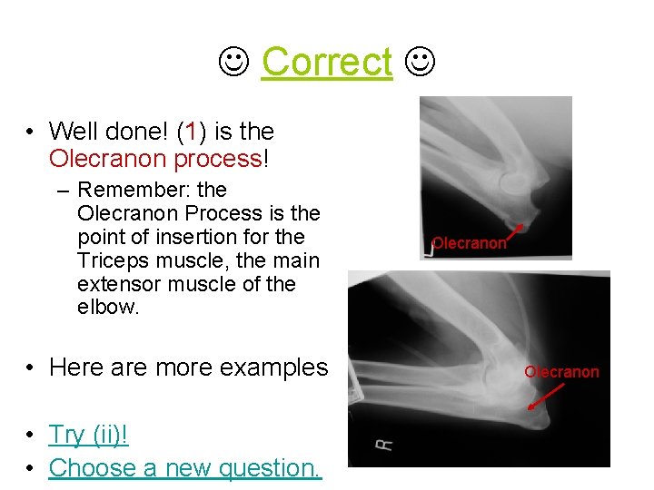  Correct • Well done! (1) is the Olecranon process! – Remember: the Olecranon