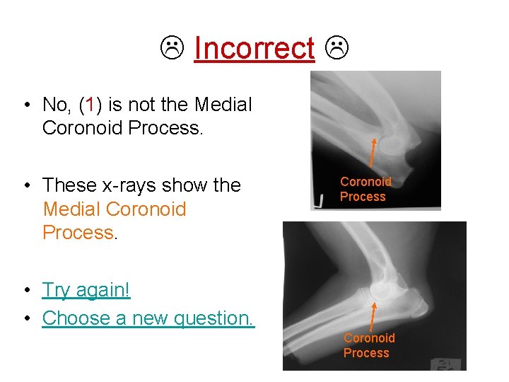  Incorrect • No, (1) is not the Medial Coronoid Process. • These x-rays