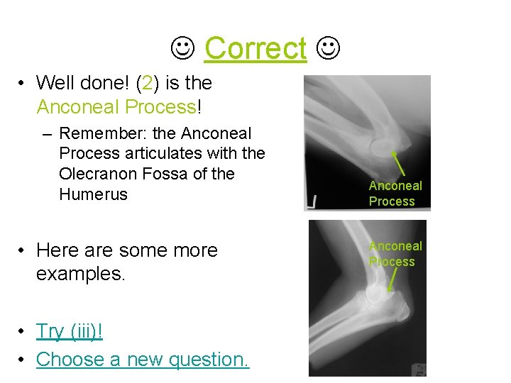  Correct • Well done! (2) is the Anconeal Process! – Remember: the Anconeal