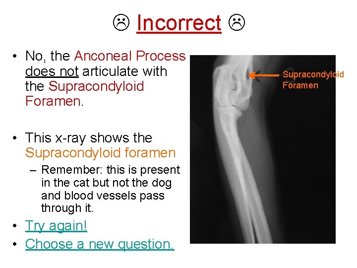  Incorrect • No, the Anconeal Process does not articulate with the Supracondyloid Foramen.