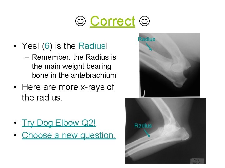  Correct • Yes! (6) is the Radius! Radius – Remember: the Radius is