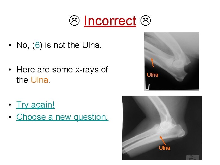  Incorrect • No, (6) is not the Ulna. • Here are some x-rays