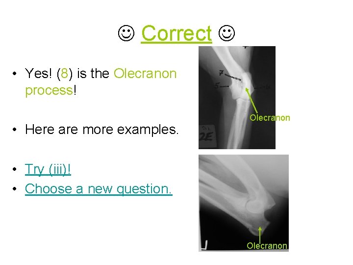  Correct • Yes! (8) is the Olecranon process! • Here are more examples.
