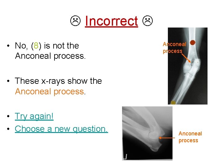  Incorrect • No, (8) is not the Anconeal process • These x-rays show